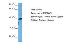 PAP39 Antibody, Novus Biologicals 100 &mu;L; Unconjugated:Antibodies, Polyclonal